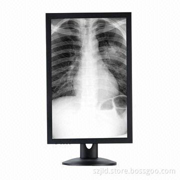 Medical LCD Monitor with VGA/DVI/HDMI®/DP Interface and 100 to 240V Input Voltage